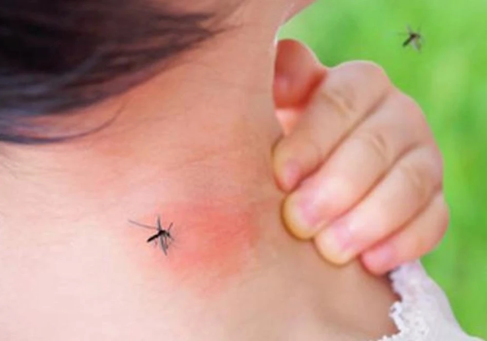 mosquito y plagas de verano